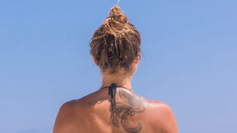 Remoción de tatuajes